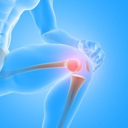 Joint replacement surgery